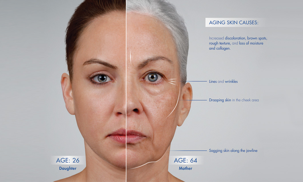 anti aging skin care